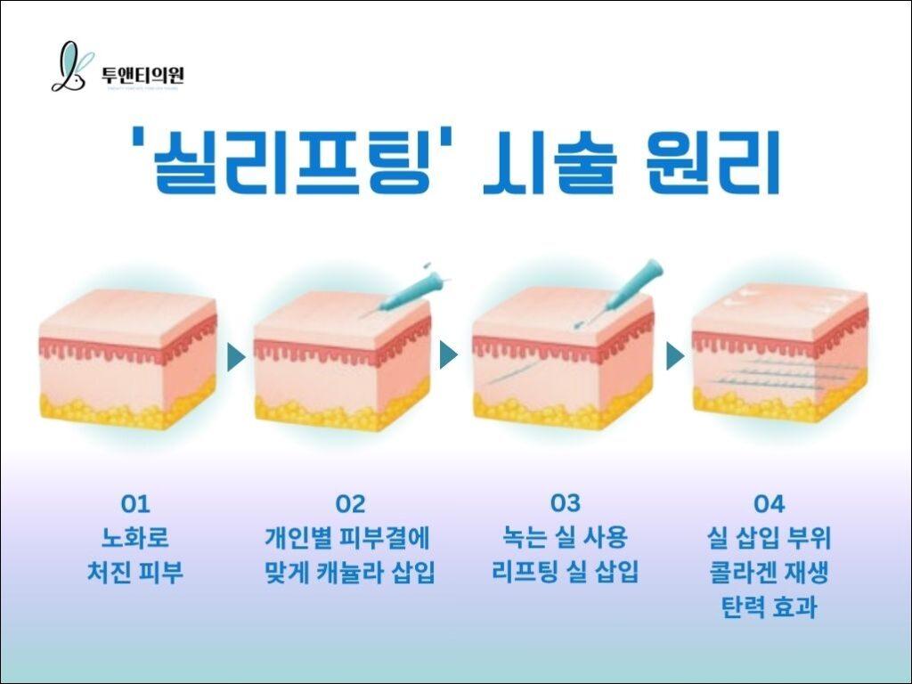 실 리프팅
