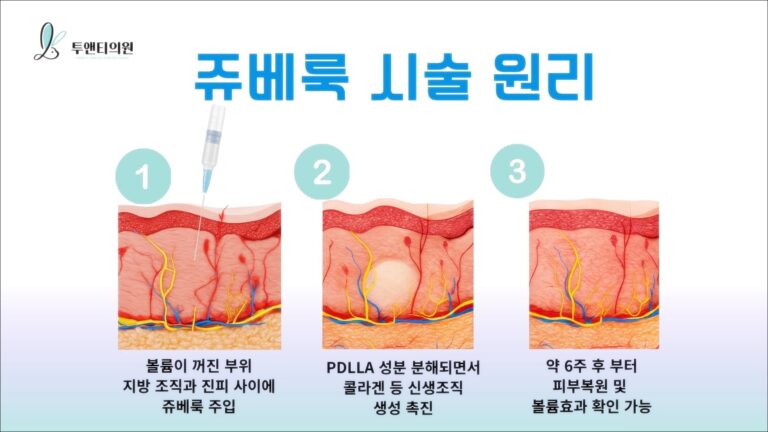 영통피부과 쥬베룩