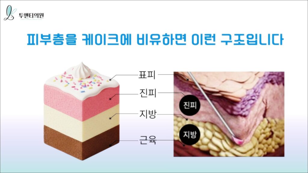 영통피부과 쥬베룩