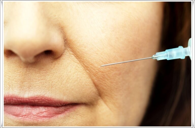 필러 쥬베룩볼륨