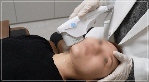 울쎄라피프라임의진화