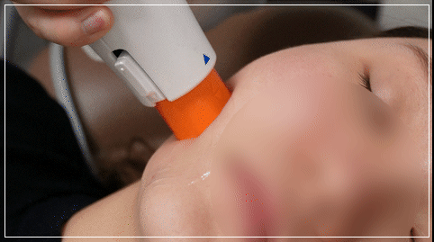 올리지오중첩조사