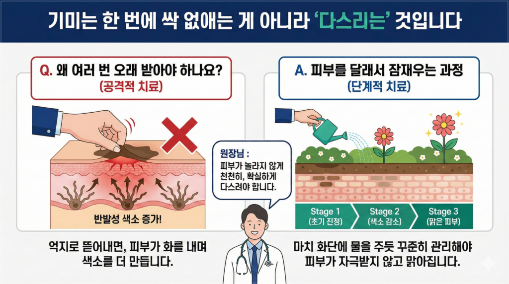 광대기미레이저