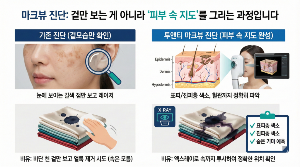 광대기미레이저