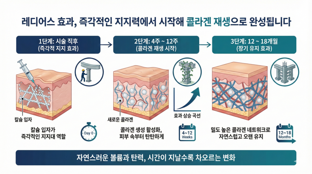 콜라겐 지지주사
