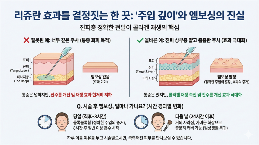 리쥬란힐러진피층재생밀도
