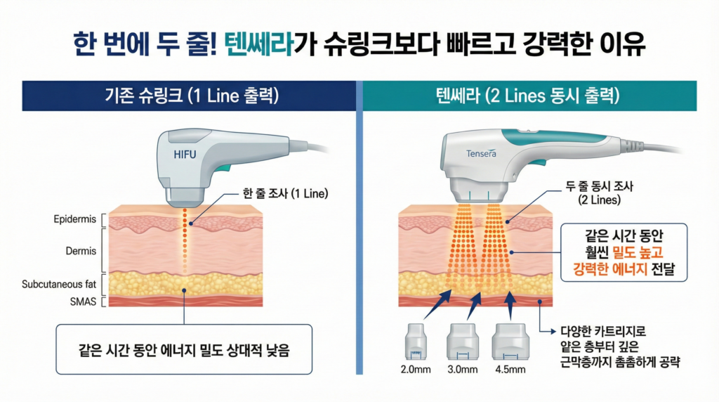 텐쎄라효과
