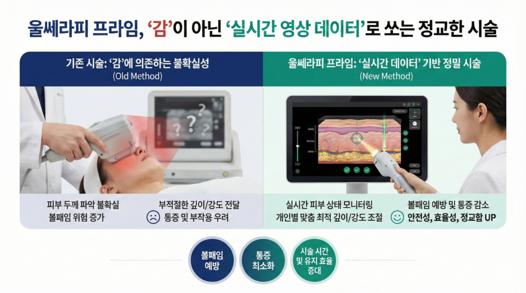 울쎄라피프라임의진화