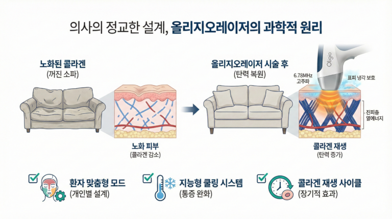 올리지오레이저, 실패 없는 리프팅을 위한 의사의 조언