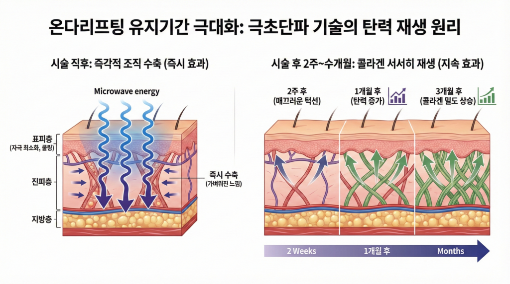온다리프팅 유지기간