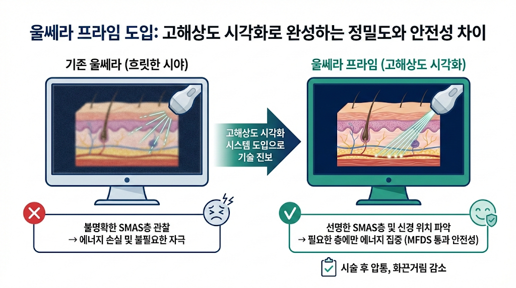 울쎄라 유명한곳