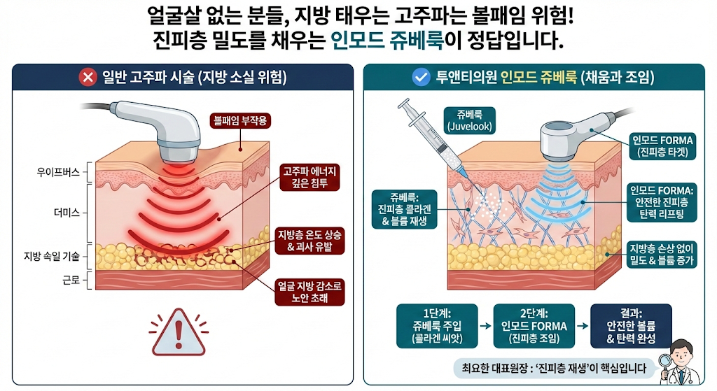 인모드 쥬베룩 