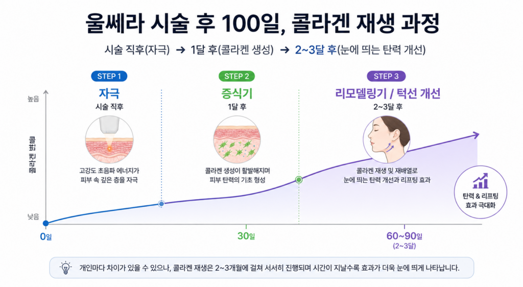 피부 층별로 다르게 설계해야 하는 망포 울쎄라 팁 깊이 비교 안내도